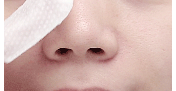 Goblin Blackhead Peeling Pad