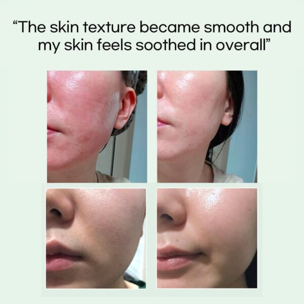 Trouble Cure Allanto-Cica Cream