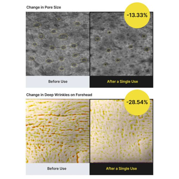 The Vita-A Retinal Shot Tightening Booster