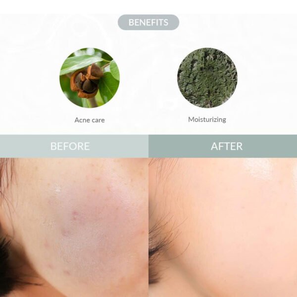 Last Minute Skin Rescue Anastatica Mask