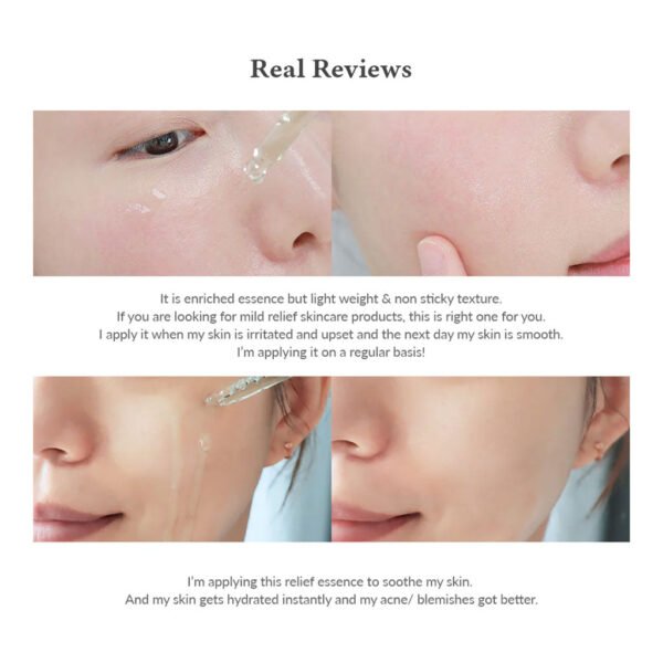 Skin Relief Essence (30ml)