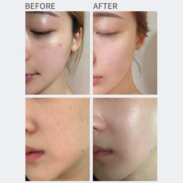 All Clean Vitamin Blemish Spot Clear Cream