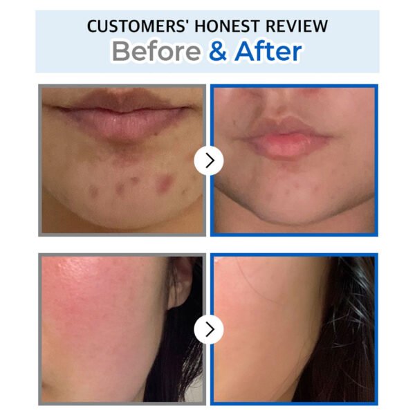 No.4 SOS Icy Soothing Sheet Mask