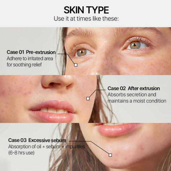 Cicamanu Clear Patch (48ea)